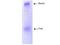 Apolipoprotein B antibody, NB120-7616, Novus Biologicals, Western Blot image 