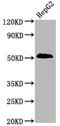 Phosphatase And Tensin Homolog antibody, CSB-RA018964A380phHU, Cusabio, Western Blot image 