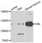 Cbl Proto-Oncogene antibody, LS-B14907, Lifespan Biosciences, Western Blot image 