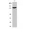 Signal Transducer And Activator Of Transcription 5A antibody, LS-C386215, Lifespan Biosciences, Western Blot image 