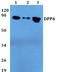 Dipeptidyl peptidase IV antibody, A00597, Boster Biological Technology, Western Blot image 