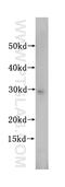 SBDS Ribosome Maturation Factor antibody, 17618-1-AP, Proteintech Group, Western Blot image 