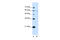 Kynureninase antibody, ARP46037_P050, Aviva Systems Biology, Western Blot image 