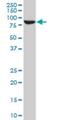 Signal Transducer And Activator Of Transcription 5B antibody, H00006777-M03, Novus Biologicals, Western Blot image 