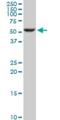 Serine/Threonine Kinase 17a antibody, H00009263-M02, Novus Biologicals, Western Blot image 