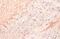 Interleukin 1 Beta antibody, GTX636887, GeneTex, Immunohistochemistry paraffin image 