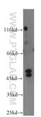 E3 ubiquitin-protein ligase TRIM31 antibody, 12543-1-AP, Proteintech Group, Western Blot image 