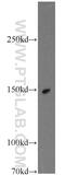 Kinectin 1 antibody, 19841-1-AP, Proteintech Group, Western Blot image 