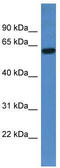 Trichoplein Keratin Filament Binding antibody, TA342972, Origene, Western Blot image 