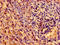 Neurotrophic Receptor Tyrosine Kinase 1 antibody, LS-C671889, Lifespan Biosciences, Immunohistochemistry paraffin image 