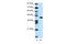 Zinc Finger And BTB Domain Containing 25 antibody, 27-878, ProSci, Western Blot image 