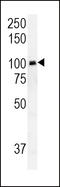 RAS Guanyl Releasing Protein 1 antibody, LS-C162458, Lifespan Biosciences, Western Blot image 