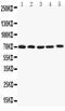 Potassium Voltage-Gated Channel Subfamily A Member 4 antibody, PA5-79549, Invitrogen Antibodies, Western Blot image 