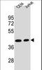 Adenosine Deaminase antibody, LS-C161006, Lifespan Biosciences, Western Blot image 