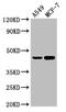Alanine--Glyoxylate And Serine--Pyruvate Aminotransferase antibody, CSB-PA001468LA01HU, Cusabio, Western Blot image 