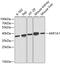 Alcohol dehydrogenase [NADP+] antibody, GTX30039, GeneTex, Western Blot image 