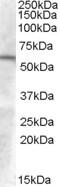 Glucosaminyl (N-Acetyl) Transferase 3, Mucin Type antibody, TA302497, Origene, Western Blot image 