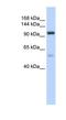 Nucleolar Protein 6 antibody, NBP1-57280, Novus Biologicals, Western Blot image 