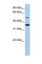 Rh Family B Glycoprotein (Gene/Pseudogene) antibody, NBP1-69483, Novus Biologicals, Western Blot image 