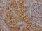 Secreted Phosphoprotein 1 antibody, CSB-RA261140A0HU, Cusabio, Immunohistochemistry paraffin image 