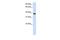 Glycosyltransferase 8 Domain Containing 2 antibody, GTX45945, GeneTex, Western Blot image 