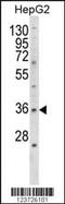 E2F Transcription Factor 5 antibody, MBS9209402, MyBioSource, Western Blot image 