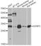 Insulin Like Growth Factor Binding Protein 5 antibody, A12451, ABclonal Technology, Western Blot image 