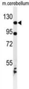 Kinesin Family Member 6 antibody, abx034425, Abbexa, Western Blot image 