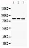 MNAT1 Component Of CDK Activating Kinase antibody, PA5-79690, Invitrogen Antibodies, Western Blot image 