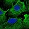 Coiled-Coil Domain Containing 69 antibody, HPA052896, Atlas Antibodies, Immunofluorescence image 