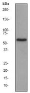 Catalase antibody, ab76024, Abcam, Western Blot image 