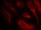 Heat Shock Transcription Factor 1 antibody, GTX50239, GeneTex, Immunocytochemistry image 