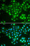 ATP Binding Cassette Subfamily A Member 3 antibody, abx005231, Abbexa, Western Blot image 