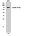 Ezrin antibody, A01750Y146, Boster Biological Technology, Western Blot image 