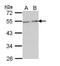 Bridging Integrator 1 antibody, PA5-28921, Invitrogen Antibodies, Western Blot image 