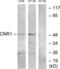 Cannabinoid Receptor 1 antibody, LS-C198818, Lifespan Biosciences, Western Blot image 