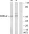 Cyclin Dependent Kinase Like 2 antibody, abx013733, Abbexa, Western Blot image 