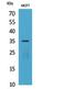 Interleukin 12A antibody, STJ96807, St John