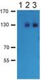 Gamma-Aminobutyric Acid Type B Receptor Subunit 2 antibody, PA1-10032, Invitrogen Antibodies, Western Blot image 