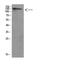 Unc-51 Like Autophagy Activating Kinase 2 antibody, A05219, Boster Biological Technology, Western Blot image 