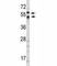 Carbonic Anhydrase 9 antibody, F48969-0.4ML, NSJ Bioreagents, Western Blot image 