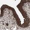 Kynurenine Aminotransferase 1 antibody, NBP1-83316, Novus Biologicals, Immunohistochemistry frozen image 