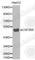 Colony Stimulating Factor 2 Receptor Alpha Subunit antibody, A2034, ABclonal Technology, Western Blot image 