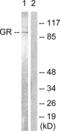 Nuclear Receptor Subfamily 3 Group C Member 1 antibody, LS-C117610, Lifespan Biosciences, Western Blot image 