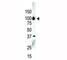 Serine/threonine-protein kinase D3 antibody, F50036-0.4ML, NSJ Bioreagents, Western Blot image 