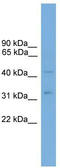 Transmembrane protein 237 antibody, TA335947, Origene, Western Blot image 