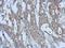 EPH Receptor A3 antibody, LS-C155360, Lifespan Biosciences, Immunohistochemistry frozen image 