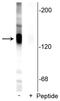 Solute Carrier Family 12 Member 5 antibody, P04629, Boster Biological Technology, Western Blot image 