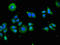 Killer Cell Immunoglobulin Like Receptor, Two Ig Domains And Short Cytoplasmic Tail 3 antibody, orb51526, Biorbyt, Immunocytochemistry image 