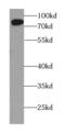 Adenosine Monophosphate Deaminase 1 antibody, FNab00370, FineTest, Western Blot image 